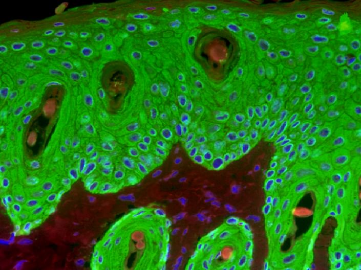 علماء يابانيون يبتكرون نهجًا يحول الخلايا الجذعية إلى مؤشرات ضوئية للتوتر والالتهاب